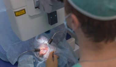 for lbringing back the light modern cataract care explained