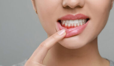 5 Signs You May Need Periodontics in Downtown