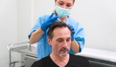 Benefits Of FUE Hair Transplant In Raleigh For Men Experiencing Hair Loss