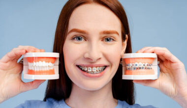 Braces Cost Factors Families in Brookhaven Should Understand