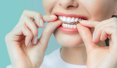 Common Mistakes To Avoid When Selecting An Orthodontist