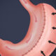 Understanding Gastric Sleeve Surgery