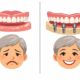 Dental Implants The Solution to Loose Dentures