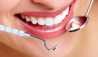 How to Analyze Which Cosmetic Dental Treatment Matches Your Smile Goals in Falls Church