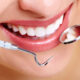 How to Analyze Which Cosmetic Dental Treatment Matches Your Smile Goals in Falls Church
