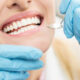Reasons Patients in South Surrey Delay Dental Visits and What Finally Changes Their Mind
