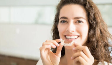 What Options Are Best for Straightening Crooked Teeth in Surrey