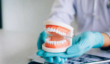 Dental Care Questions