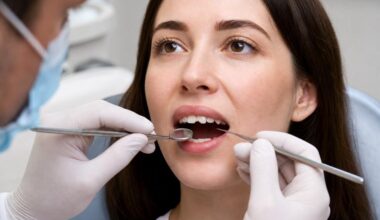 Small Smile Repairs Smarter Choices