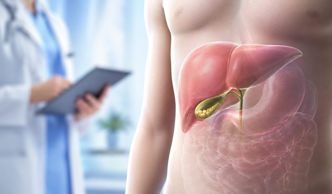 Cholecystectomy and Gallstones