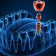 Practical Ways to Improve Dental Implant Workflows