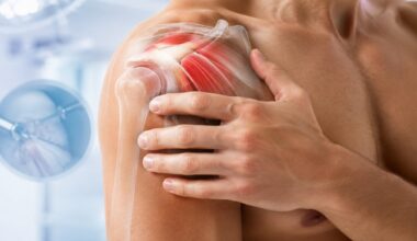 Shoulder Arthroscopy and Shoulder Tendonitis