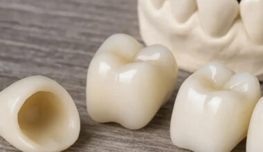 Dental Restorations