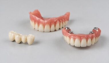 From Missing Teeth to Daily Confidence An Orlando Florida Tooth Replacement Guide