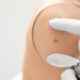 Skin Cancer Checks and Your Skin Type What Most Australians Get Wrong