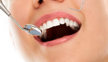Transforming Smiles How Modern Aesthetic Dentistry Blends Artistry and Function